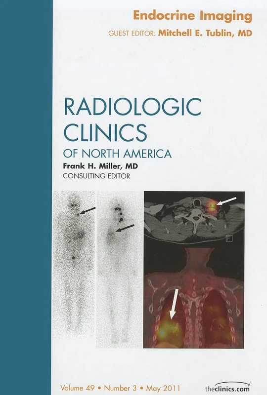 Endocrine Imaging, An Issue of Radiologic Clinics of North America (Volume 49-3) (The Clinics: Radiology, Volume 49-3)