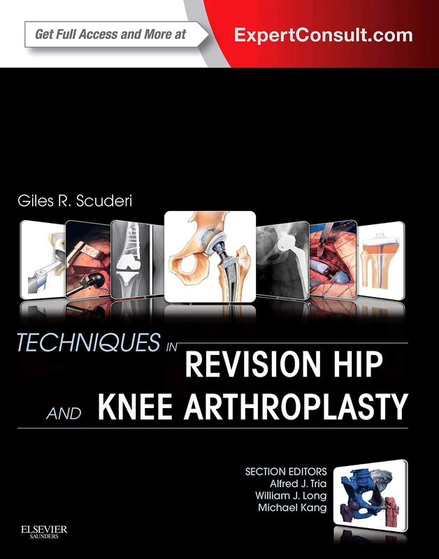 Techniques in Revision Hip and Knee Arthroplasty