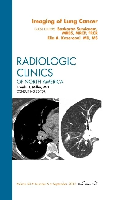 Imaging of Lung Cancer, An Issue of Radiologic Clinics of North America (Volume 50-5) (The Clinics: Radiology, Volume 50-5)