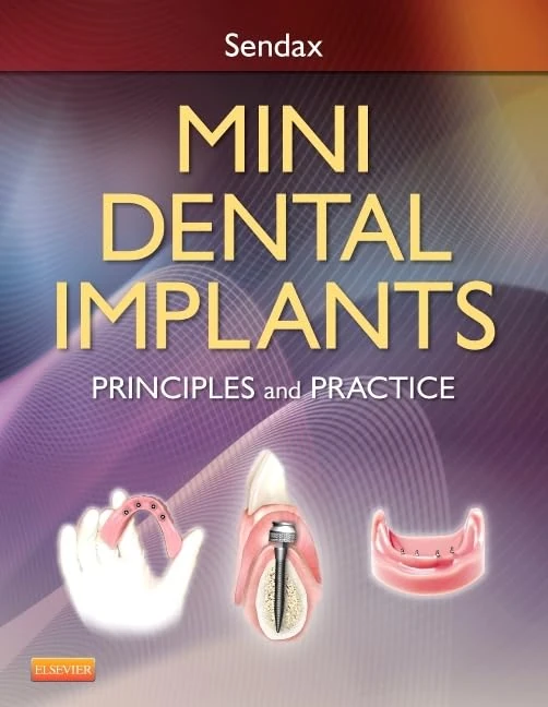 Mini Dental Implants: Principles and Practice