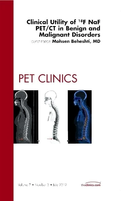 Clinical Utility of 18NaF PET/CT in Benign and Malignant Disorders, An Issue of PET Clinics (Volume 7-3) (The Clinics: Radiology, Volume 7-3)