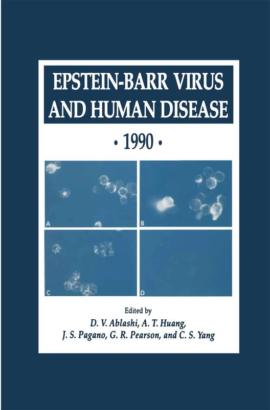 Epstein-Barr Virus and Human Disease · 1990: 24 (Experimental Biology and Medicine, 24)