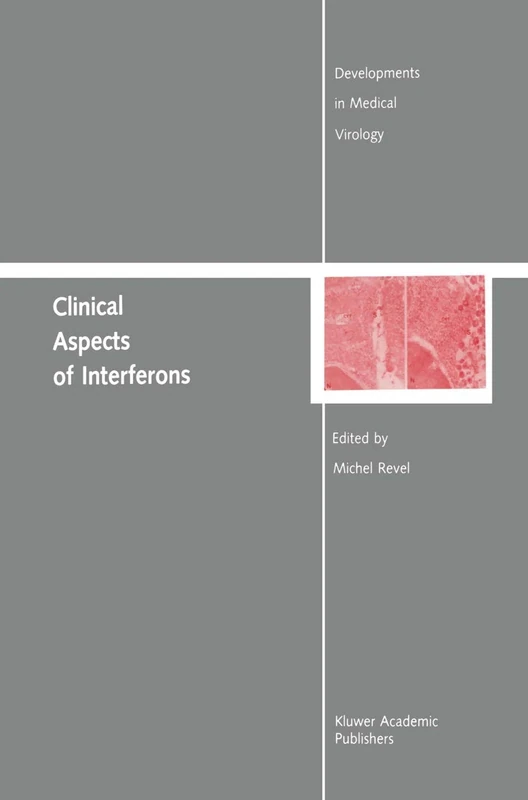 Clinical Aspects of Interferons: 4 (Developments in Medical Virology, 4)