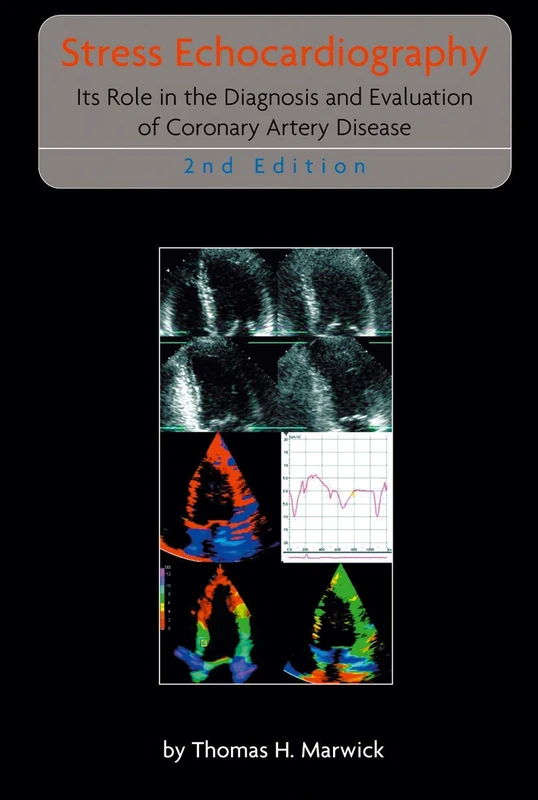 Stress Echocardiography: Its Role in the Diagnosis and Evaluation of Coronary Artery Disease: 247 (Developments in Cardiovascular Medicine, 247)