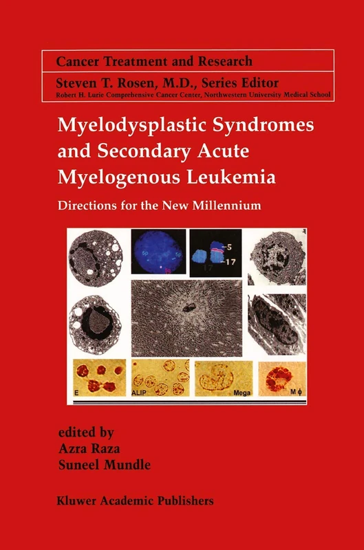 Myelodysplastic Syndromes & Secondary Acute Myelogenous Leukemia: Directions for the New Millennium: 108 (Cancer Treatment and Research, 108)