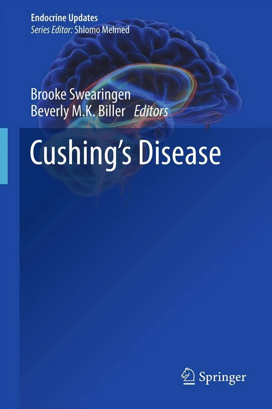 Cushing's Disease: 31 (Endocrine Updates, 31)