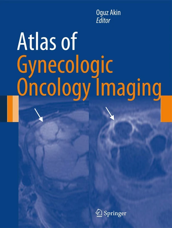 Atlas of Gynecologic Oncology Imaging (Atlas of Oncology Imaging)