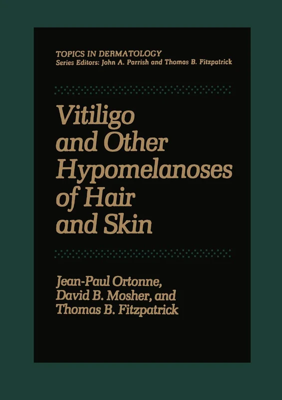 Vitiligo and Other Hypomelanoses of Hair and Skin (Topics in Dermatology)