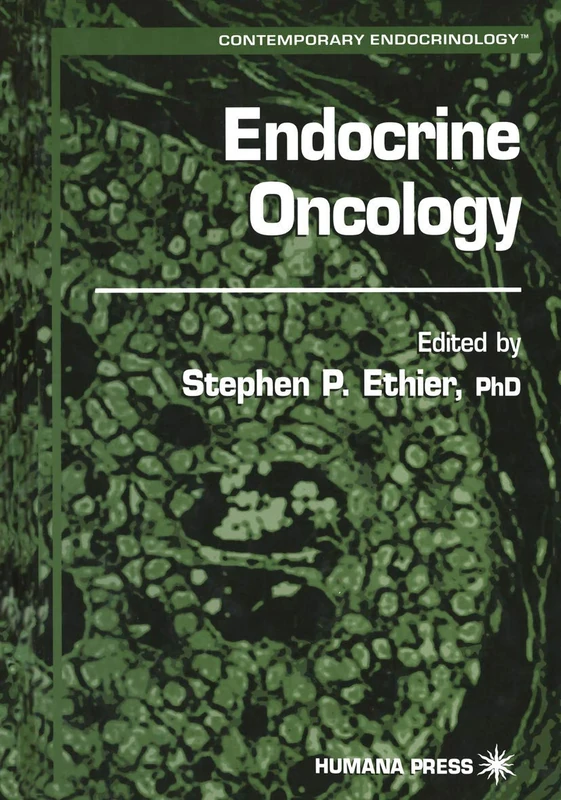 Endocrine Oncology (Contemporary Endocrinology)
