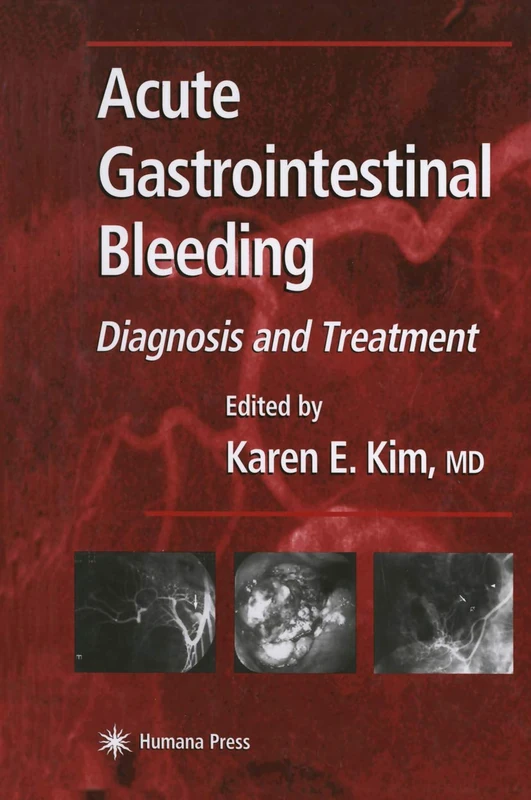 Acute Gastrointestinal Bleeding: Diagnosis and Treatment (Clinical Gastroenterology)