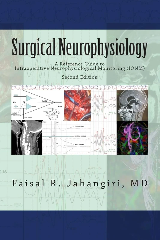 Surgical Neurophysiology - 2nd Edition: A Reference Guide to Intraoperative Neurophysiological Monitoring: Volume 2