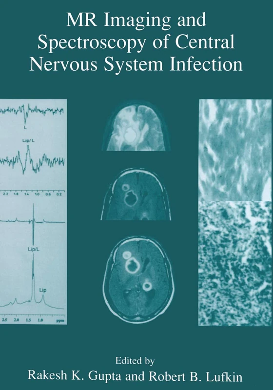 MR Imaging and Spectroscopy of Central Nervous System Infection - Image 1