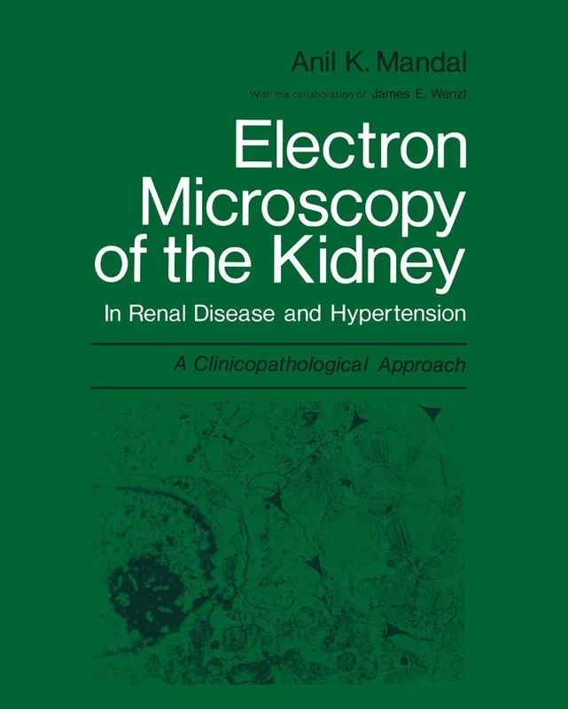 Electron Microscopy of the Kidney: In Renal Disease and Hypertension: A Clinicopathological Approach