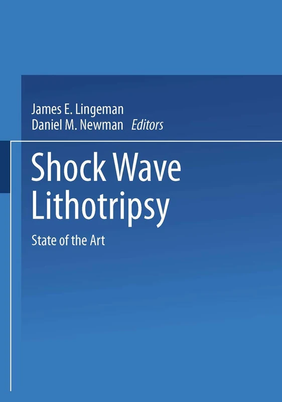Shock Wave Lithotripsy: State of the Art