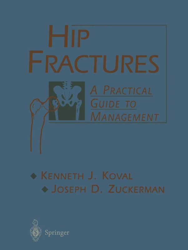 Hip Fractures: A Practical Guide to Management