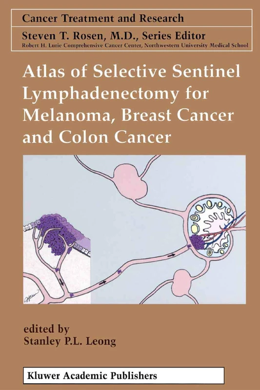 Atlas of Selective Sentinel Lymphadenectomy for Melanoma, Breast Cancer and Colon Cancer: 111 (Cancer Treatment and Research, 111)