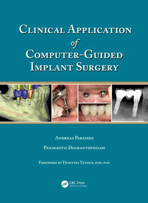 CRC Press - Clinical Application of Computer-Guided Implant Surgery