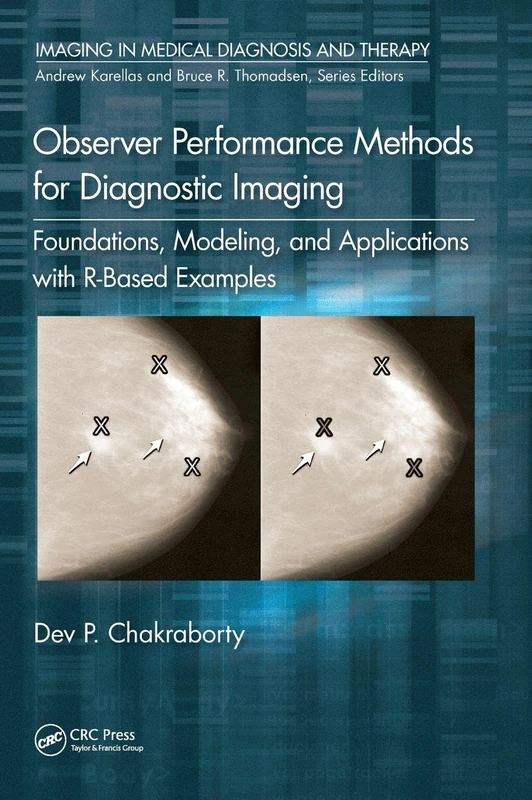 Observer Performance Methods for Diagnostic Imaging: Foundations, Modeling, and Applications with R-Based Examples (Imaging in Medical Diagnosis and Therapy)