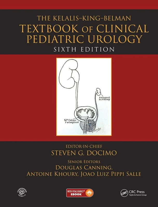 The Kelalis--King--Belman Textbook of Clinical Pediatric Urology: Textbook of Clinical Pediatric Urology