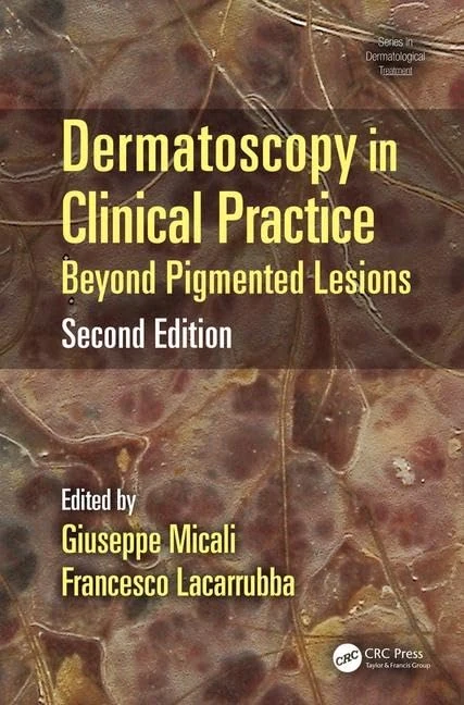 CRC Press Dermatoscopy in Clinical Practice - Medical Book