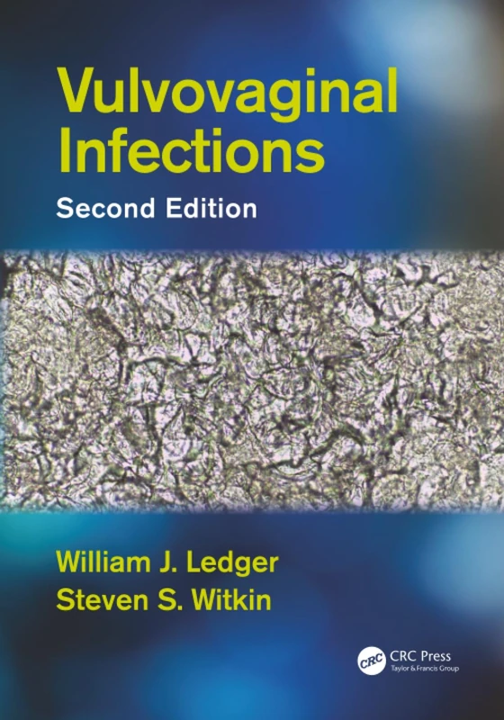 Vulvovaginal Infections