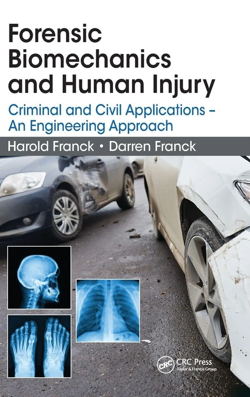Forensic Biomechanics and Human Injury: Criminal and Civil Applications - An Engineering Approach