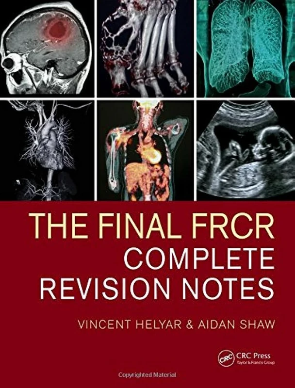 The Final FRCR: Complete Revision Notes