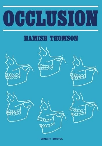 Occlusion