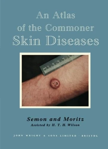 An Atlas of the Commoner Skin Diseases: With 153 Plates Reproduced by Direct Colour Photography from the Living Subject