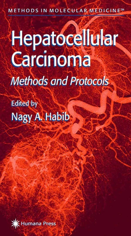 Hepatocellular Carcinoma: Methods and Protocols: 45 (Methods in Molecular Medicine)