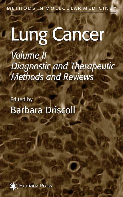 Lung Cancer: Volume 2: Diagnostic and Therapeutic Methods and Reviews: 75 (Methods in Molecular Medicine, 75)