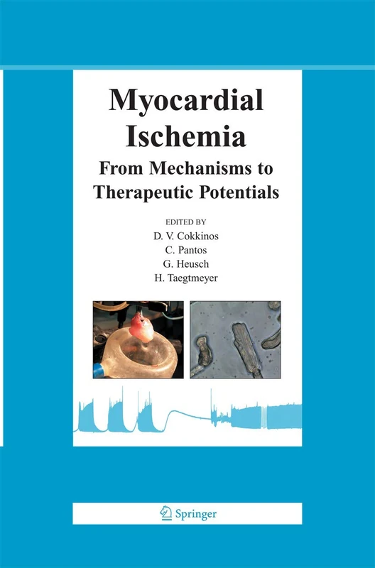 Myocardial Ischemia: From Mechanisms to Therapeutic Potentials: 21 (Basic Science for the Cardiologist, 21)