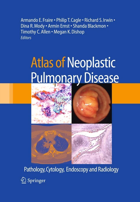 Springer Atlas of Neoplastic Pulmonary Disease Medical Atlas