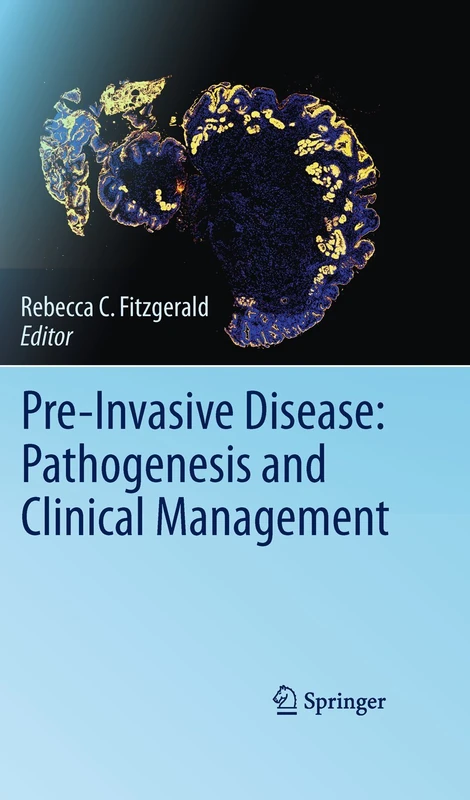 Springer - Pre-Invasive Disease: Pathogenesis and Management