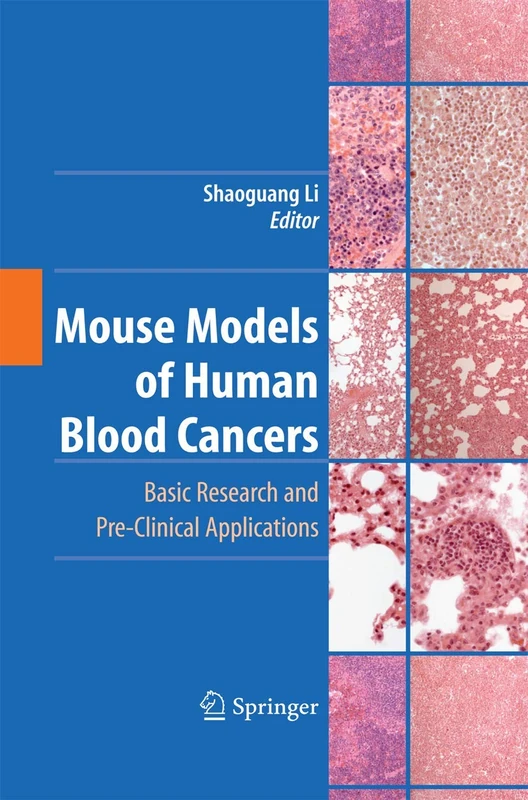 Mouse Models of Human Blood Cancers: Basic Research and Pre-clinical Applications - Image 1