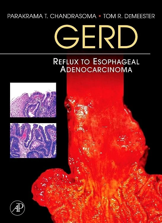 GERD: Reflux to Esophageal Adenocarcinoma