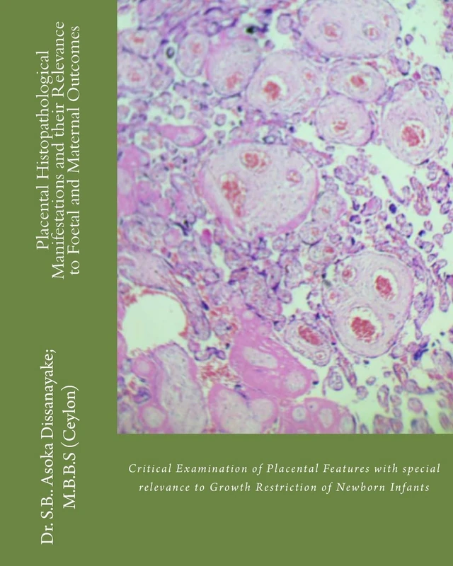 Placental Histopathological Manifestations and their Relevance to Foetal and Maternal Outcomes: Defining Intrauterine Growth Retardation and Maternal Nutritional Status