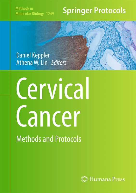 Cervical Cancer: Methods and Protocols: 1249 (Methods in Molecular Biology, 1249)
