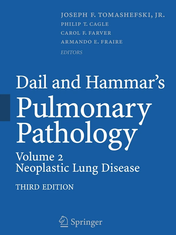 Dail and Hammar's Pulmonary Pathology: Volume II: Neoplastic Lung Disease