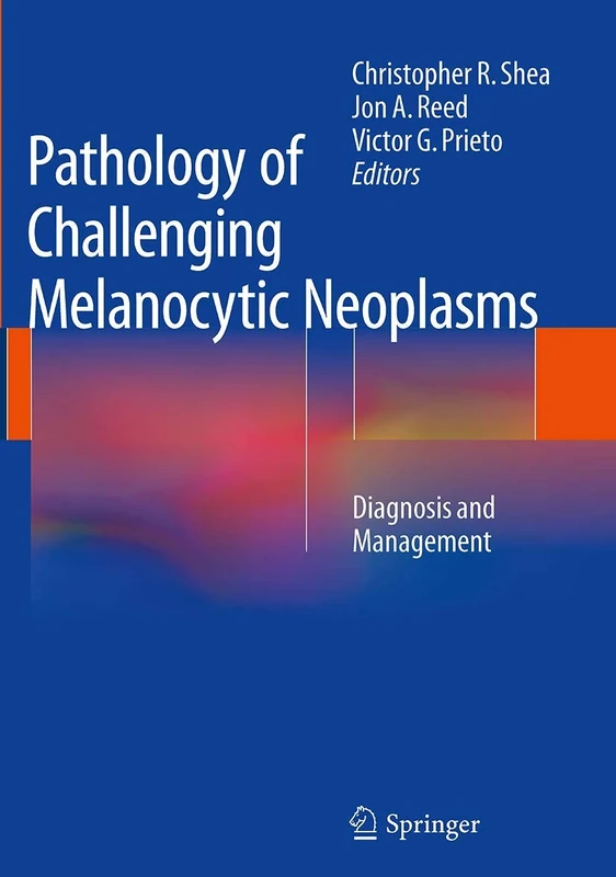 Pathology of Challenging Melanocytic Neoplasms: Diagnosis and Management