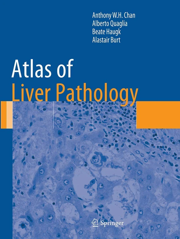 Atlas of Liver Pathology (Atlas of Anatomic Pathology)