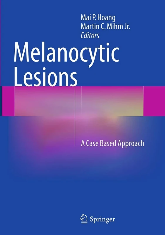 Melanocytic Lesions: A Case Based Approach