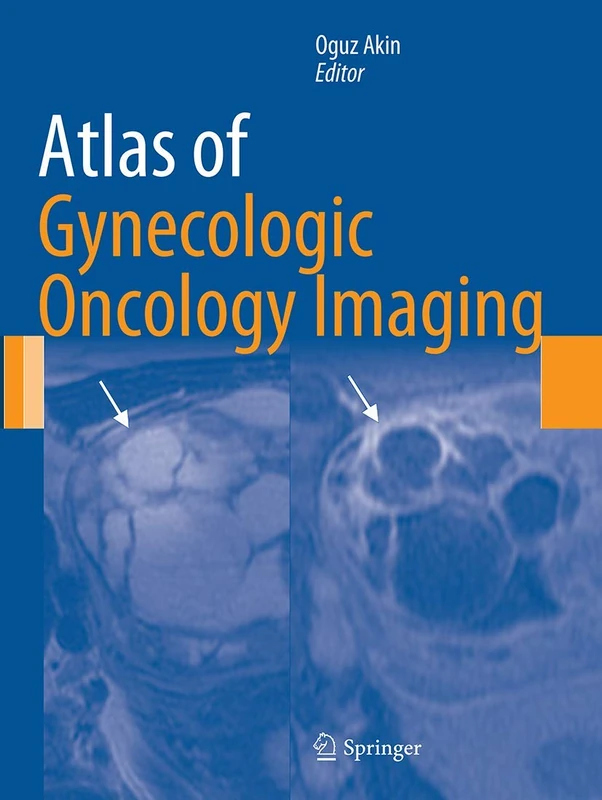 Atlas of Gynecologic Oncology Imaging (Atlas of Oncology Imaging)