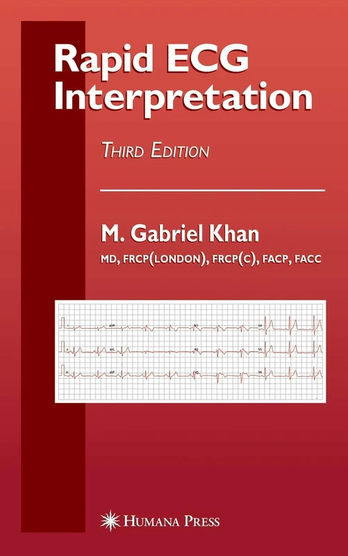 Rapid ECG Interpretation (Contemporary Cardiology)