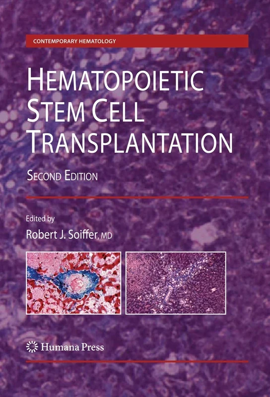 Hematopoietic Stem Cell Transplantation (Contemporary Hematology)