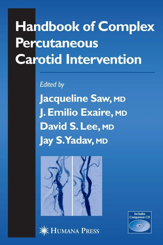 Handbook of Complex Percutaneous Carotid Intervention (Contemporary Cardiology)