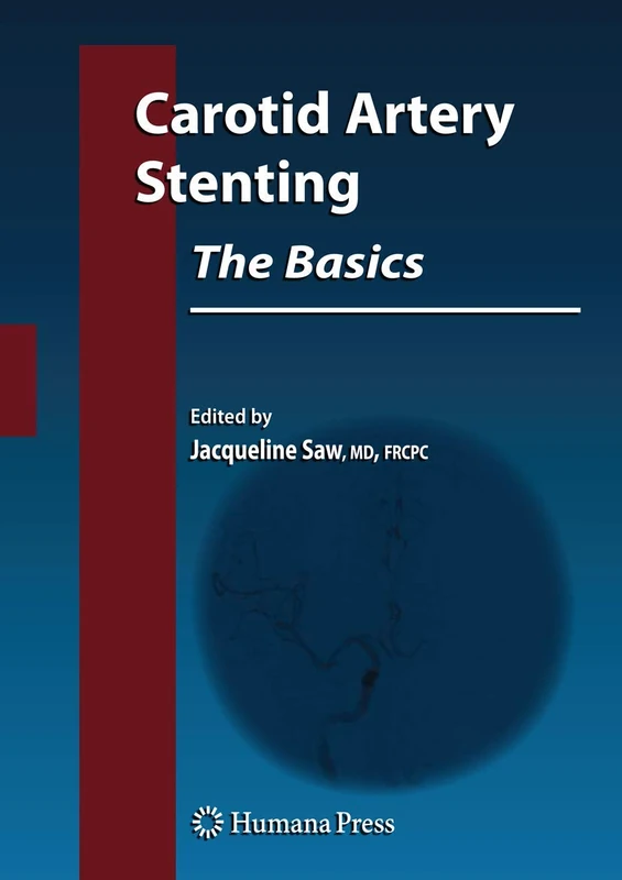 Carotid Artery Stenting: The Basics (Contemporary Cardiology)