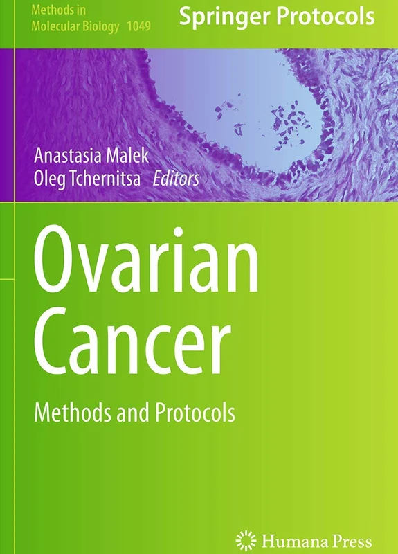 Ovarian Cancer: Methods and Protocols: 1049 (Methods in Molecular Biology, 1049)