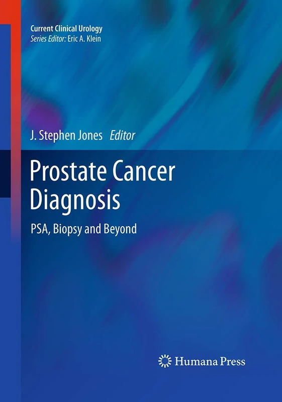 Prostate Cancer Diagnosis: PSA, Biopsy and Beyond (Current Clinical Urology)