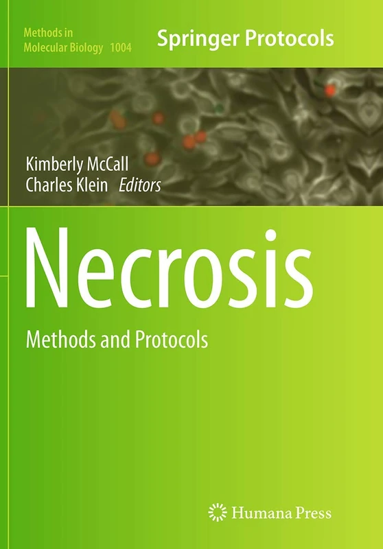Necrosis: Methods and Protocols: 1004 (Methods in Molecular Biology, 1004)